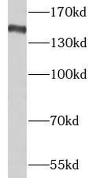 NPC1 Rabbit Polyclonal Antibody