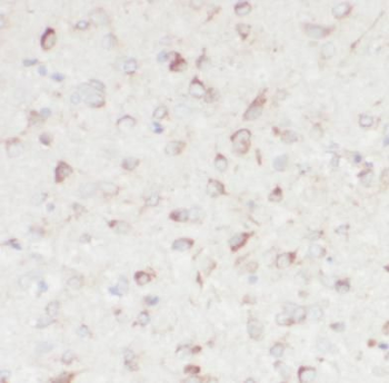 NPC1 Rabbit Polyclonal Antibody