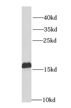 NPC2 Rabbit Polyclonal Antibody