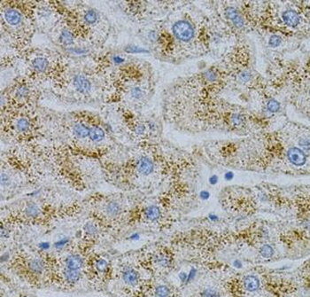 NPC2 Rabbit Polyclonal Antibody