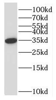 NPL Rabbit Polyclonal Antibody