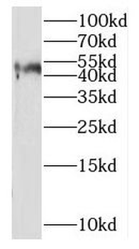 NPTX2 Rabbit Polyclonal Antibody