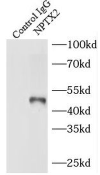 NPTX2 Rabbit Polyclonal Antibody