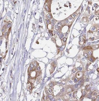 NPTX2 Rabbit Polyclonal Antibody