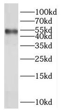 NR2F1 Rabbit Polyclonal Antibody