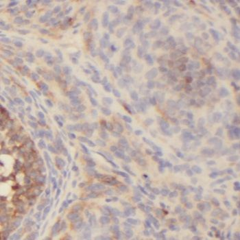 NR2F1 Rabbit Polyclonal Antibody