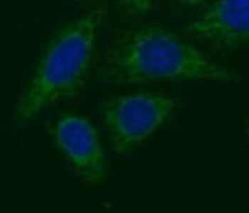 NRG1 Rabbit Polyclonal Antibody