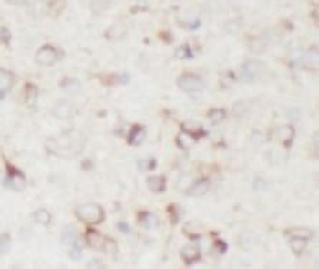 ENO2 Rabbit Polyclonal Antibody