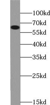 NT5E Rabbit Polyclonal Antibody