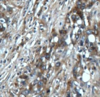 NT5E Rabbit Polyclonal Antibody