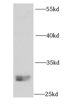 NTF3 Rabbit Polyclonal Antibody