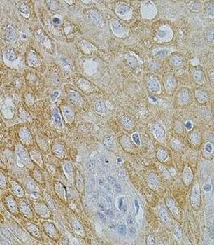 NTF3 Rabbit Polyclonal Antibody