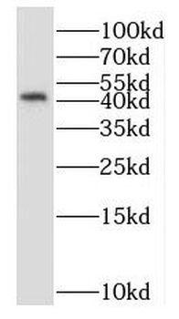 NUCKS1 Rabbit Polyclonal Antibody