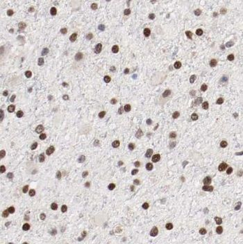 NUCKS1 Rabbit Polyclonal Antibody