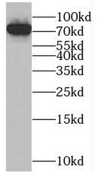 NUDT6 Rabbit Polyclonal Antibody