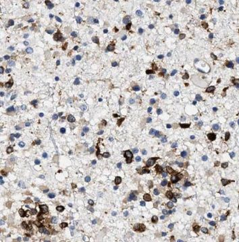 NUDT6 Rabbit Polyclonal Antibody
