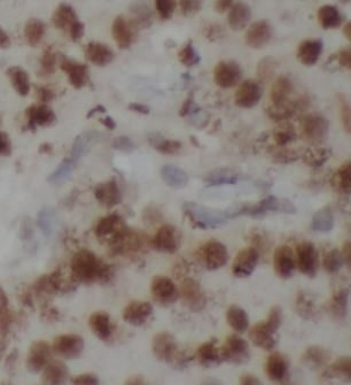 NUMA1 Rabbit Polyclonal Antibody