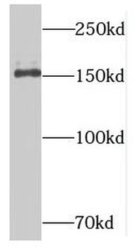 NUP153 Rabbit Polyclonal Antibody