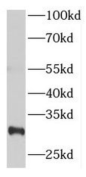 NUP62CL Rabbit Polyclonal Antibody