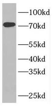 NUP85 Rabbit Polyclonal Antibody