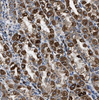 NUP85 Rabbit Polyclonal Antibody
