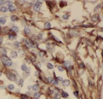 ODAM Rabbit Polyclonal Antibody