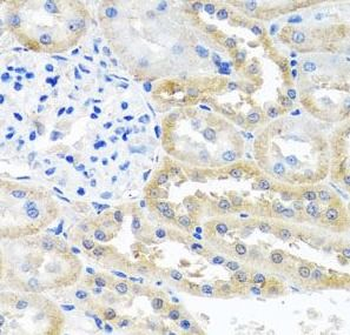 OGFR Rabbit Polyclonal Antibody