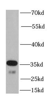 OGG1 Rabbit Polyclonal Antibody