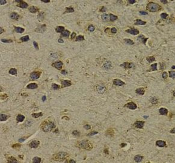 OGG1 Rabbit Polyclonal Antibody