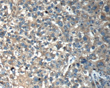 OLFM3 Rabbit Polyclonal Antibody