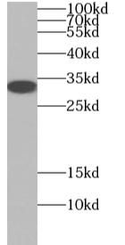 OLIG2 Rabbit Polyclonal Antibody
