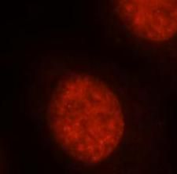 OLIG2 Rabbit Polyclonal Antibody