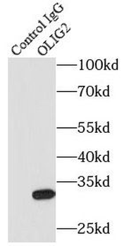 OLIG2 Rabbit Polyclonal Antibody