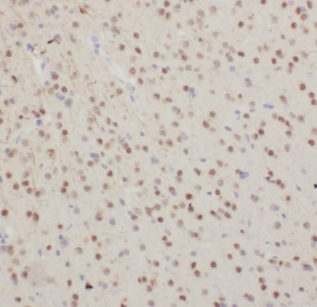 OLIG2 Rabbit Polyclonal Antibody