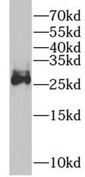 OLR1 Rabbit Polyclonal Antibody