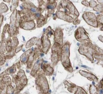 OLR1 Rabbit Polyclonal Antibody