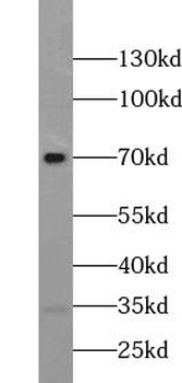 OPTN Rabbit Polyclonal Antibody