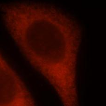 OPTN Rabbit Polyclonal Antibody