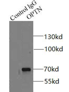 OPTN Rabbit Polyclonal Antibody