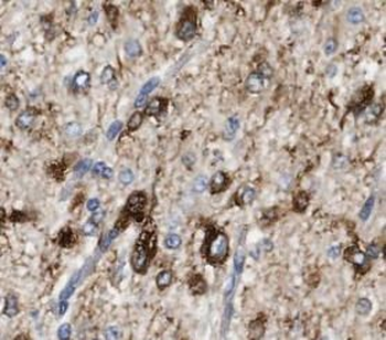 OPTN Rabbit Polyclonal Antibody