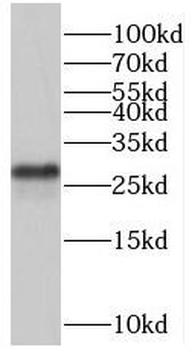 ORC6 Rabbit Polyclonal Antibody