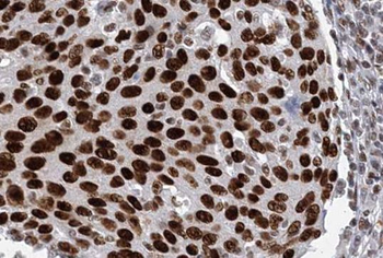 ORC6 Rabbit Polyclonal Antibody