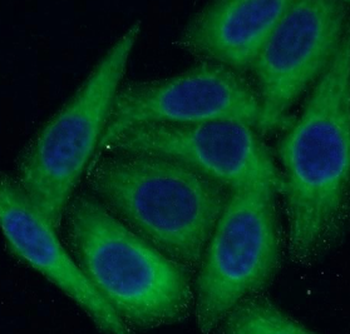 SPP1 Rabbit Polyclonal Antibody