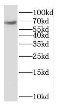 OTOP1 Rabbit Polyclonal Antibody