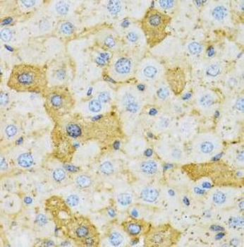 OXA1L Rabbit Polyclonal Antibody