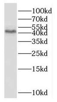 OXER1 Rabbit Polyclonal Antibody