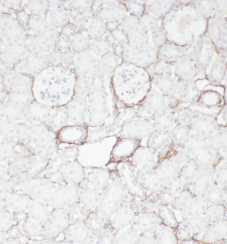 OXER1 Rabbit Polyclonal Antibody