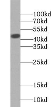 OXTR Rabbit Polyclonal Antibody