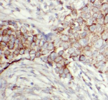 OXTR Rabbit Polyclonal Antibody