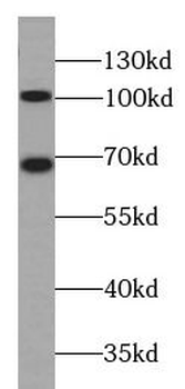 CTNND1 Rabbit Polyclonal Antibody